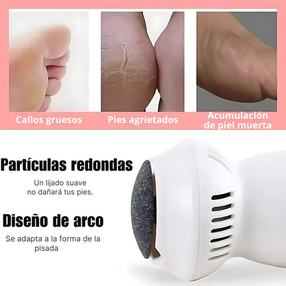 TenderToes™ REMOVEDOR DE CALLOS Y DUREZAS, PIES SUAVES