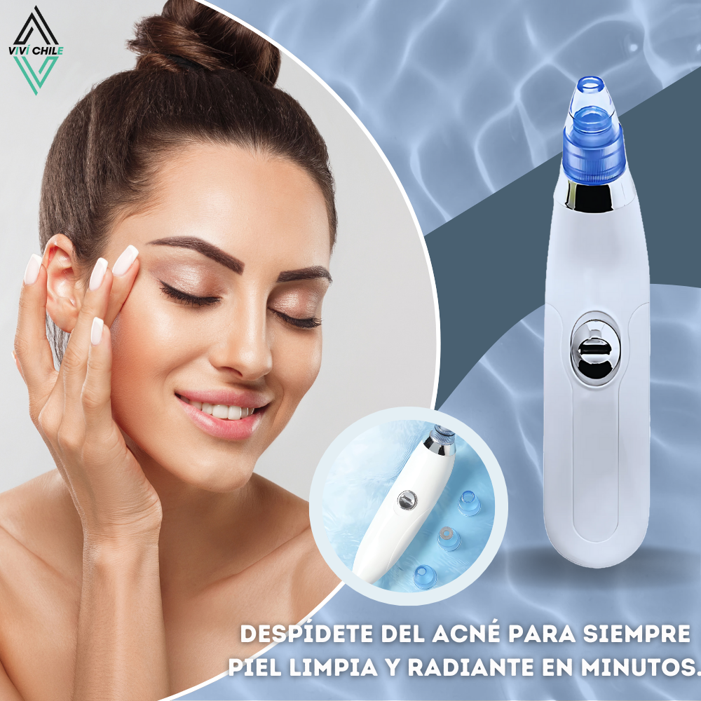 AcneFix™ REMOVEDOR ELECTRICO DE ACNE