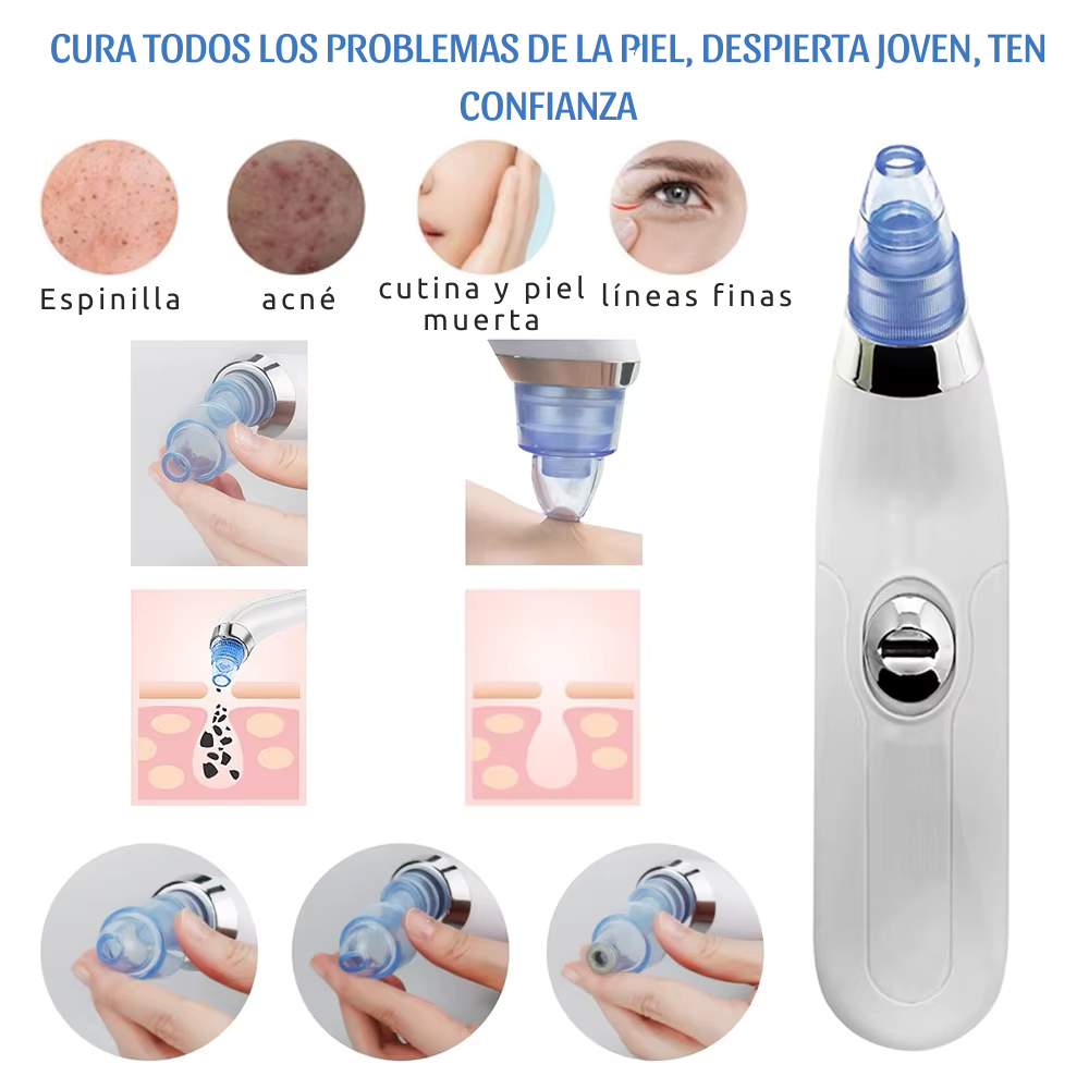 AcneFix™ REMOVEDOR ELECTRICO DE ACNE