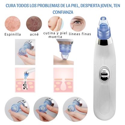 AcneFix™ REMOVEDOR ELECTRICO DE ACNE